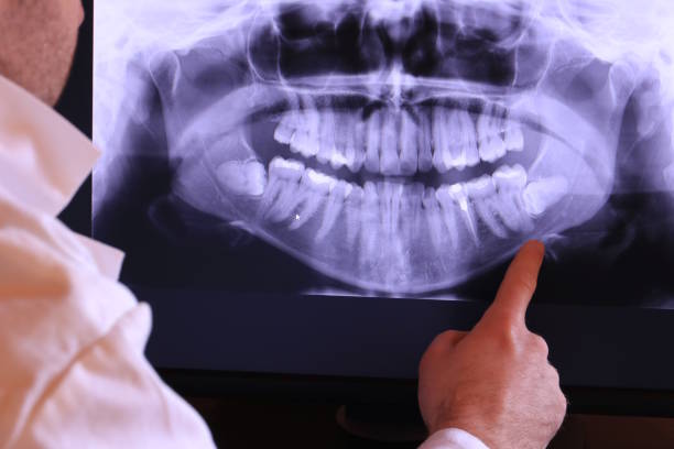Best Knocked-Out Tooth Emergency  in North Canton, OH